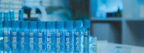 Laboratorio de farmacogenética.